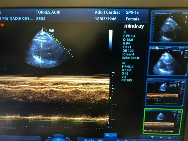 MINDRAY-M9-Ultrasound-2