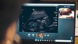 Philips Lumify Portable Ultrasound