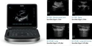 SONOSITE EDGE II Transducers