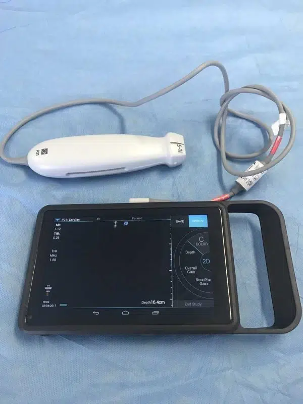 Sonosite iVIZ Ultrasound Machine - Image 3